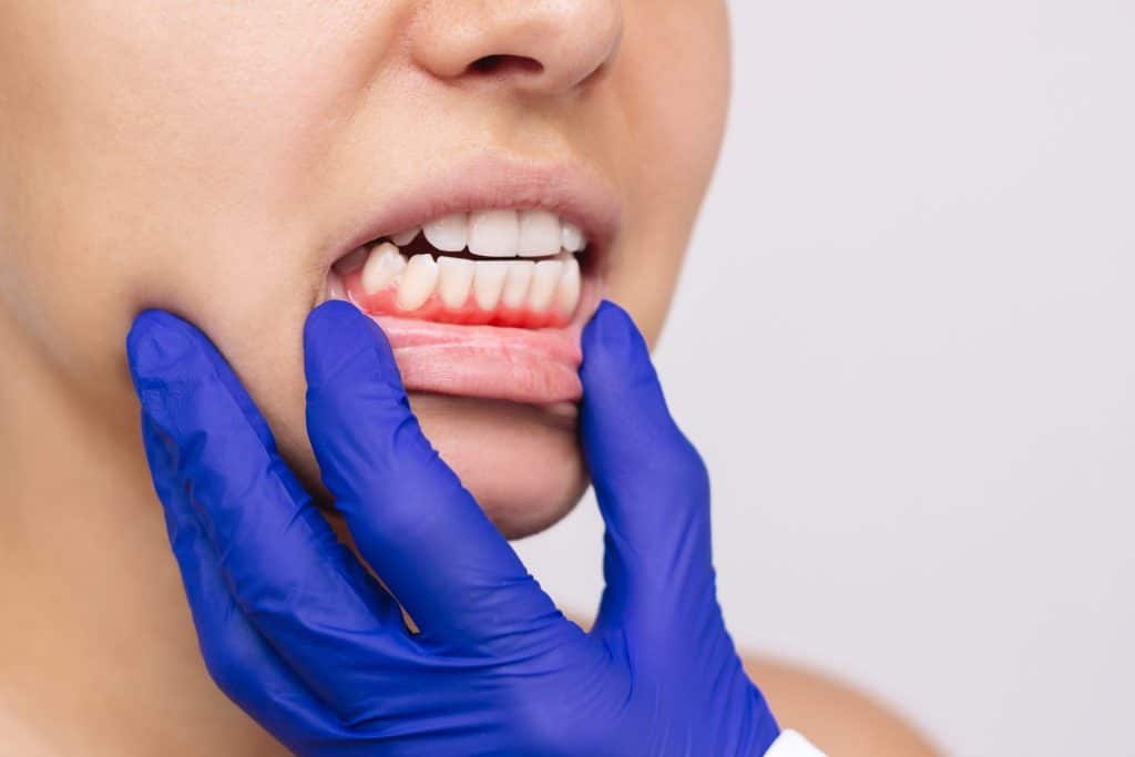 full-mouth reconstruction millersville